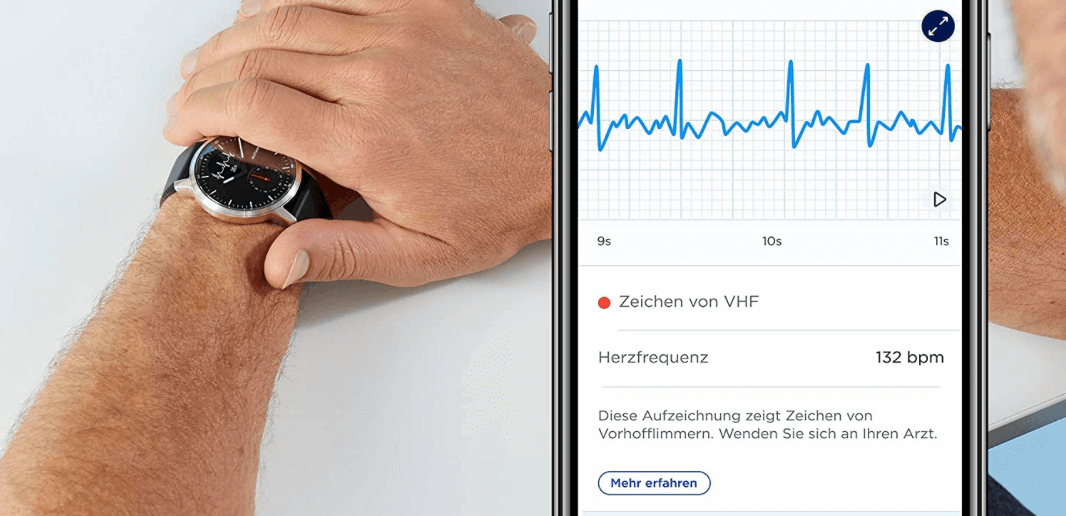 Withings Scanwatch