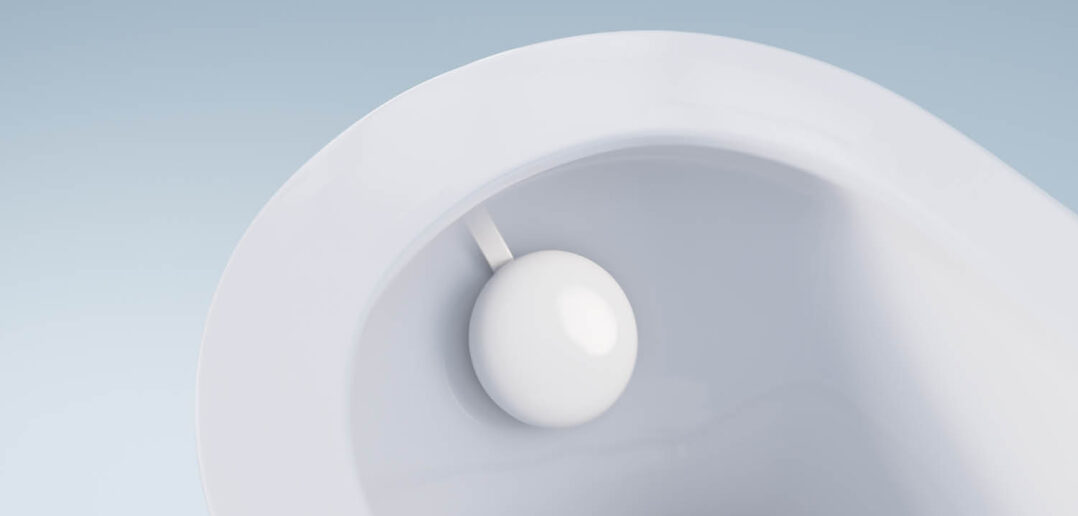 Withings U-Scan News