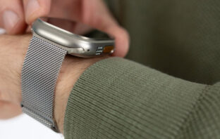 Apple Watch Series 12: Armbänder erstmals mit Sensoren?